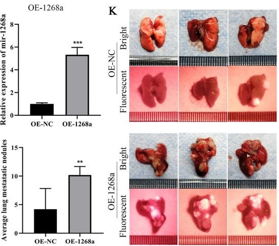 LUYOR-3415用於觀察小鼠黑色素瘤轉移